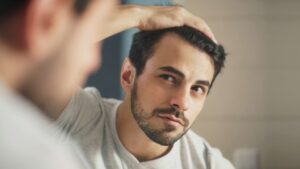 greffe cheveux hommes