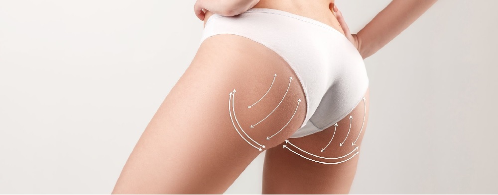 reduction fesses Turquie